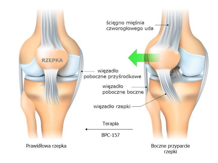 BPC-157 Peptide Therapy for the Support of Sports Injuries in Athletes and Physically Active Individuals